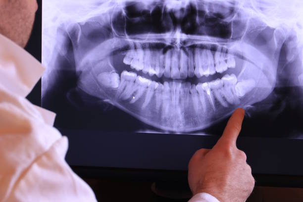 Best Urgent Care for Lost Fillings or Crowns in Cherryvale, SC